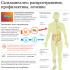 How to avoid salmonellosis: prevention and causes of infection What needs to be done in order not to get sick with salmonellosis