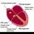 Heart colitis during menstruation - who to contact Tachycardia after menstruation