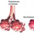 Elecampane high - rhizomes and roots Elecampane rhizomes and roots ultrasound scanner application