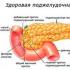 Chronic pancreatitis - symptoms, causes, treatment, diet and exacerbation in adults